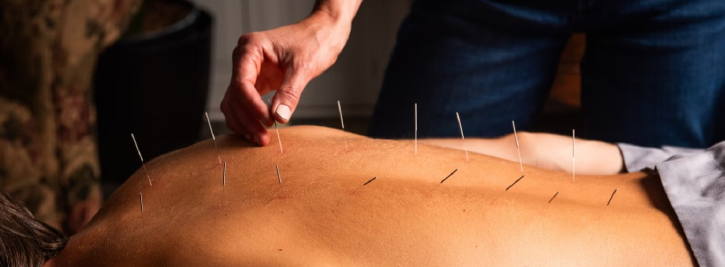 Acupuncture & Chinese Medicine