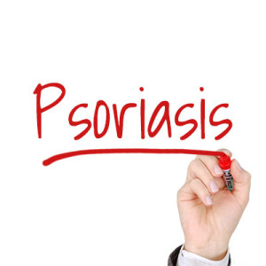 Blog-img-5-Alternative-Treatments_640_-ALTERNATE1-300x300