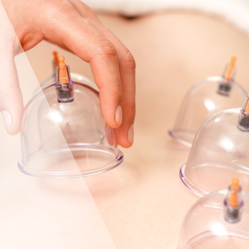 blog2-oct23-cupping-sq