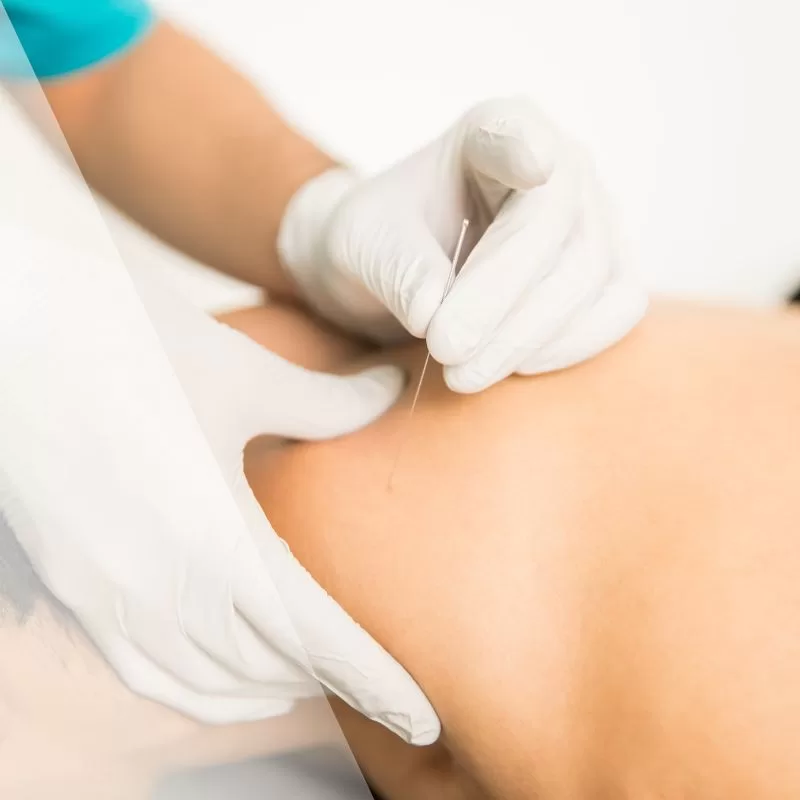 apw-blog-sep24-dryneedling-sq-jpg