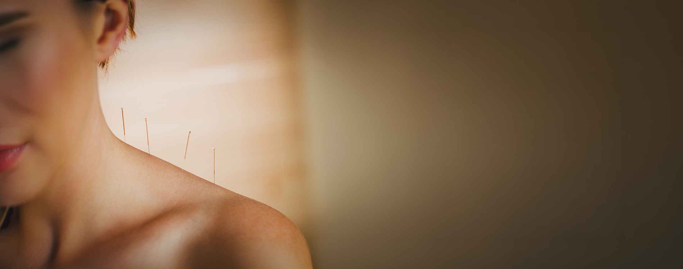 Acupuncture in Geneva IL