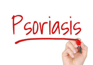 Blog-img-5-Alternative-Treatments_640_-ALTERNATE1-300x300