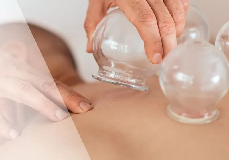 apw-blog-mar26-cupping-sq