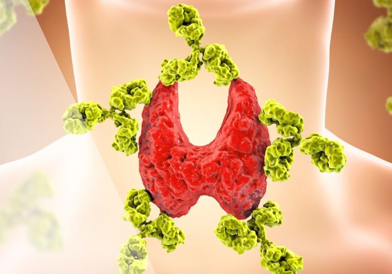 apw-blog-may24-autoimmune-sq