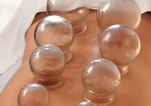cupping